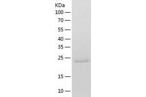 Western Blotting (WB) image for RAN Binding Protein 3 (RANBP3) (AA 235-445) protein (His-IF2DI Tag) (ABIN7124774)