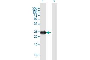 Western Blot analysis of INS-IGF2 expression in transfected 293T cell line by INS-IGF2 MaxPab polyclonal antibody. (INS-IGF2 anticorps  (AA 1-200))