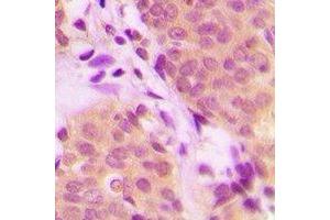 Immunohistochemistry (IHC) image for anti-Tripartite Motif Containing 21 (TRIM21) antibody (ABIN7308440)