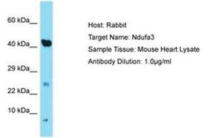 Image no. 1 for anti-NADH Dehydrogenase (Ubiquinone) 1 alpha Subcomplex, 3, 9kDa (NDUFA3) (C-Term) antibody (ABIN6749908) (NDUFA3 anticorps  (C-Term))