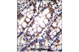 UQCRFS1 Antibody (C-term) (ABIN655606 and ABIN2845090) immunohistochemistry analysis in formalin fixed and paraffin embedded human rectum tissue followed by peroxidase conjugation of the secondary antibody and DAB staining.