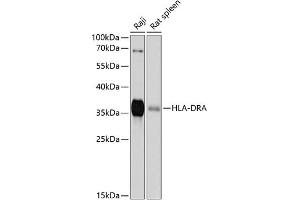 Western blot analysis of extracts of various cell lines, using HLA-DRA antibody (ABIN6131757, ABIN6141827, ABIN6141829 and ABIN6215475) at 1:1000 dilution. (HLA-DRA anticorps  (AA 26-216))