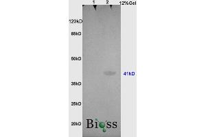 L1 rat brain, L2 , human colon carcinoma lysates probed (ABIN728773) at 1:200 in 4 °C.