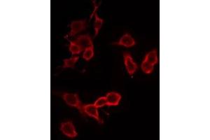 ABIN6274875 staining HeLa by IF/ICC. (ATP5C1 anticorps  (Internal Region))