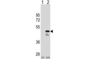 Western Blotting (WB) image for anti-Obg-Like ATPase 1 (OLA1) antibody (ABIN2998785) (OLA1 anticorps)