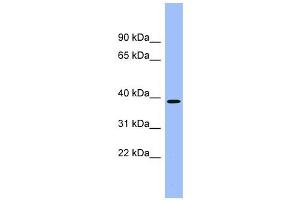 ACMSD antibody used at 1 ug/ml to detect target protein. (ACMSD anticorps  (Middle Region))