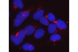 IF analysis of Golgin 97/GOLGA1 using anti-Golgin 97/GOLGA1 antibody (ABIN7599538). (GOLGA1 anticorps  (AA 1-752))