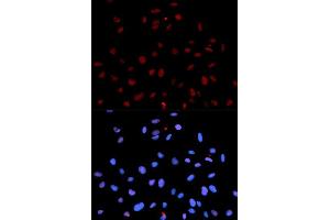 Immunofluorescence analysis of U2OS cells using Phospho-MET-Y1235 antibody (ABIN5969924). (c-MET anticorps  (pTyr1235))