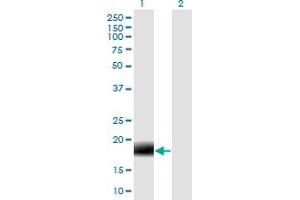 Western Blot analysis of 2-Mar expression in transfected 293T cell line by MARCH2 monoclonal antibody (M04), clone 7F3. (MARCH2 anticorps  (AA 1-176))