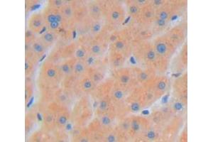 Used in DAB staining on fromalin fixed paraffin- embedded Kidney tissue