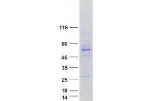 Validation with Western Blot