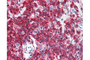 Anti-CD45RA antibody IHC of human spleen. (CD45RA anticorps  (FITC))