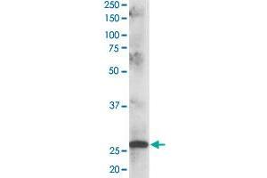 CLPP polyclonal antibody  staining (1 ug/mL) of human muscle lysate (RIPA buffer, 35 ug total protein per lane). (CLPP anticorps)
