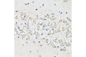 Immunohistochemistry of paraffin-embedded mouse brain using NUDC antibody.