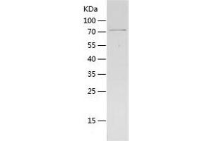 Western Blotting (WB) image for GDP Dissociation Inhibitor 2 (GDI2) (AA 1-445) protein (His-IF2DI Tag) (ABIN7123069)
