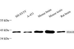 Western blot analysis of RRAGB (ABIN7075379),at dilution of 1: 1000 (RRAGB anticorps)