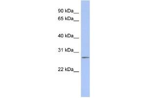 WB Suggested Anti-C14orf166 Antibody Titration:  0. (C14orf166 anticorps  (Middle Region))