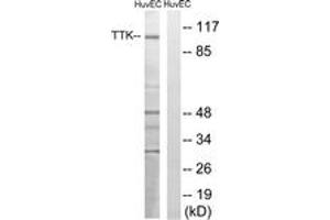 Western blot analysis of extracts from HuvEc cells, treated with etoposide 25uM 24H, using TTK (Ab-676) Antibody.