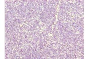 Immunohistochemistry of paraffin-embedded human thymus tissue using ABIN7162540 at dilution of 1:100 (ZDHHC16 anticorps  (AA 288-377))