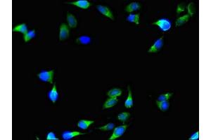 Immunofluorescent analysis of Hela cells using ABIN7148328 at dilution of 1:100 and Alexa Fluor 488-congugated AffiniPure Goat Anti-Rabbit IgG(H+L) (C1QTNF9B anticorps  (AA 2-192))