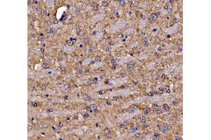 IHC analysis of Gephyrin/GPHN using anti-Gephyrin/GPHN antibody (ABIN7600086). (Gephyrin anticorps  (AA 148-736))