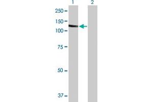 Western Blot analysis of SLC4A1 expression in transfected 293T cell line by SLC4A1 MaxPab polyclonal antibody. (Band 3/AE1 anticorps  (AA 1-911))