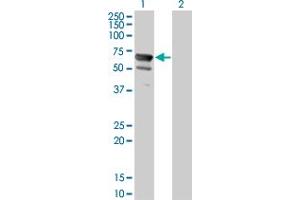 Western Blot analysis of NT5C2 expression in transfected 293T cell line by NT5C2 monoclonal antibody (M02), clone 3C1. (NT5C2 anticorps  (AA 1-561))