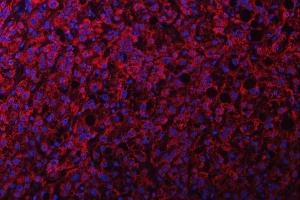 IF analysis of NDUFS2 using anti-NDUFS2 antibody (ABIN7599417).