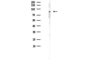 Western blot analysis of lysates from K562 cells(heat-shock 45 min treatment), using Phospho-SA (Ser780) Antibody at 1/1000 dilution.