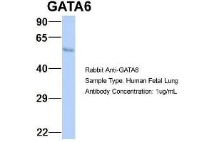 Host:  Rabbit  Target Name:  GATA6  Sample Type:  Human Fetal Lung  Antibody Dilution:  1. (GATA6 anticorps  (N-Term))