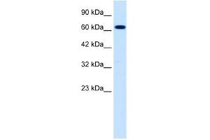 WB Suggested Anti-SCNN1B Antibody Titration:  0. (SCNN1B anticorps  (C-Term))