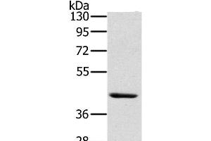 Western Blot analysis of Skov3 cell using HSD3B7 Polyclonal Antibody at dilution of 1:400 (HSD3B7 anticorps)