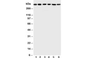 Western blot testing of Mucin-5AC antibody and Lane 1:  SGC;  2: HeLa;  3: COLO320;  4: SW620;  5: MCF-7;  6: PANC lysate; Predicted size: ~500KD, Observed size: 300KD+