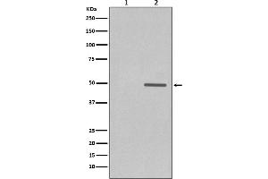 Western blot analysis of Phospho-Cyclin E1 (T77) expression in (1) JAR cell treated with Lambda Phosphatase lysate, (2) JAR cell lysate.