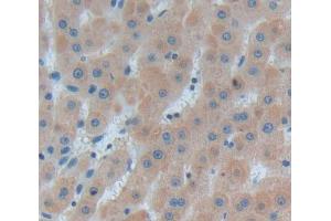 Used in DAB staining on fromalin fixed paraffin- embedded Kidney tissue