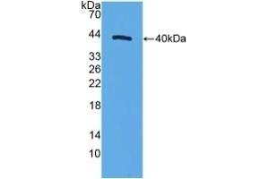Detection of Recombinant MRP1, Human using Polyclonal Antibody to Motility Related Protein (MRP1) (CD9 anticorps  (AA 112-195))