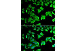 Immunofluorescence analysis of MCF-7 cells using RPS12 antibody (ABIN5973491). (RPS12 anticorps)