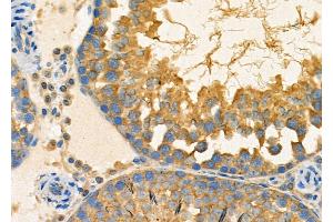 ABIN6263383 and ABIN6267002 at 1/100 staining Rat testis tissue by IHC-P. (MRRF anticorps  (Internal Region))