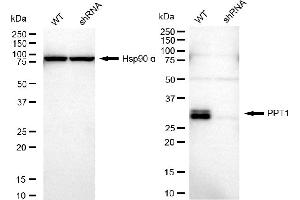 Western blotting analysis using PPT1 antibody (ABIN7799730).