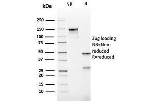 SDS-PAGE Analysis Purified Bcl-2 Mouse Recombinant Monoclonal Antibody (rBCL2/782).