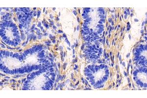 Detection of COL1a1 in Human Uterus Tissue using Monoclonal Antibody to Collagen Type I Alpha 1 (COL1a1)