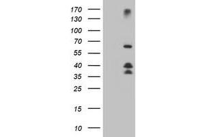 Western Blotting (WB) image for anti-Dystrobrevin, beta (DTNB) antibody (ABIN1497917) (Dystrobrevin beta anticorps)