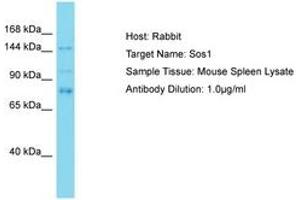 Image no. 1 for anti-Son of Sevenless Homolog 1 (SOS1) (AA 353-402) antibody (ABIN6750497) (SOS1 anticorps  (AA 353-402))