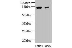 Western blot All lanes: WDR49 antibody at 7 μg/mL Lane 1: A549 whole cell lysate Lane 2: Hela whole cell lysate Secondary Goat polyclonal to rabbit IgG at 1/10000 dilution Predicted band size: 80, 60 kDa Observed band size: 80 kDa (WDR49 anticorps  (AA 251-500))
