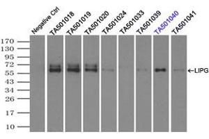 Image no. 2 for anti-Lipase, Endothelial (LIPG) antibody (ABIN1499162) (LIPG anticorps)
