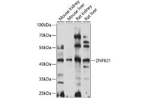 Western blot analysis of extracts of various cell lines, using ZNF621 antibody  at 1:1000 dilution. (ZNF621 anticorps  (AA 60-150))