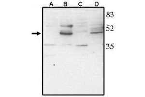 Image no. 1 for anti-Visual System Homeobox 2 (VSX2) (AA 264-361), (C-Term) antibody (ABIN265010) (VSX2 anticorps  (C-Term))