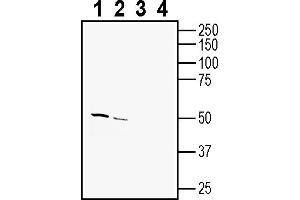 anti-Transmembrane Protein 175 (TMEM175) (AA 278-291) antibody