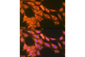 Immunofluorescence analysis of C6 cells using PGE Receptor EP2 (PGE Receptor EP2 (PGE receptor EP2 (PTGER2))) Rabbit mAb (ABIN7269572) at dilution of 1:100 (40x lens).