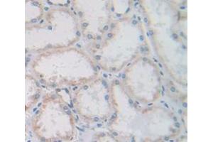 IHC-P analysis of Human Tissue, with DAB staining. (CUBN anticorps  (AA 3157-3274))
